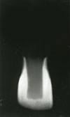 MOORREES classification system (1963): 1/4 root formation