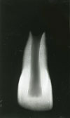 MOORREES classification system (1963): 3/4 root formation