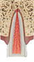 Enamel-dentin fracture